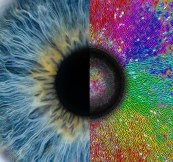 Human eye (left half) and Radial alignment of cells on a soft inhomogeneous substrate with an embedded glass bead at the center (right half) Credits: Michael Morse via pexels and Dr Akshada Khadpekar. (Lead author of the study)