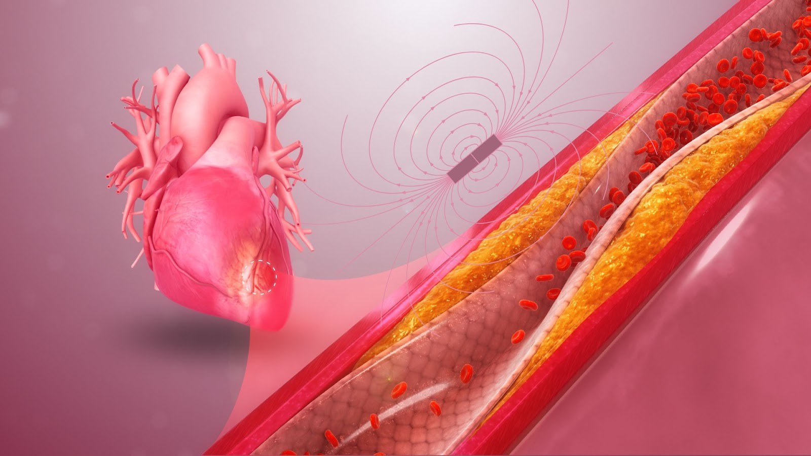 This image has been adapted to suit the story's needs under the Creative Commons Attribution-Share Alike 4.0 International license. Credits to the original image: http://www.scientificanimations.com, via Wikimedia Commons